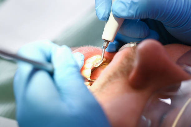 Best Broken Tooth Emergency  in Endwell, NY