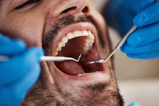 Best Emergency Dental Filling Replacement  in Endwell, NY